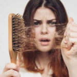 Kadınlarda Erkek Tipi Saç Dökülmesi