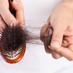 saç dökülmesi tedavisi