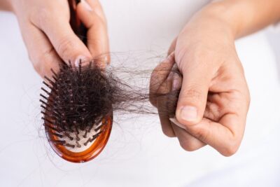 Behandlung von Haarausfall